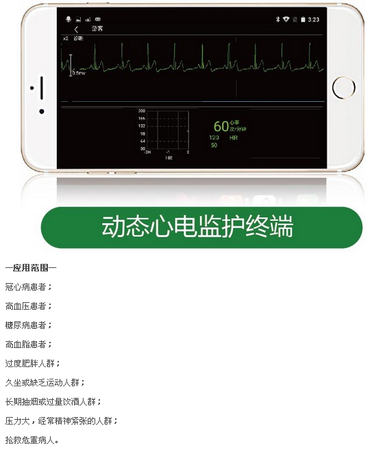 动态心电监护